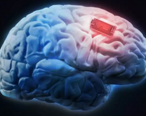 AI拯救记忆：植入大脑第一步 也是资本风口下一步